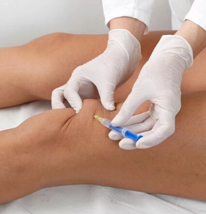 Ozonoterapia